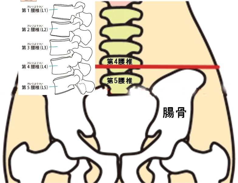 腰痛 骨盤矯正3段階